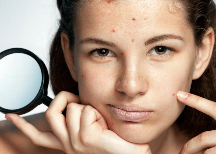 Подростковая косметология